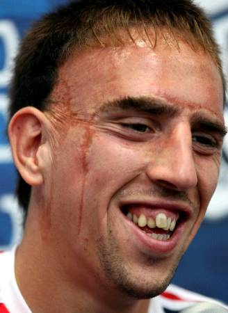 franck-ribery1