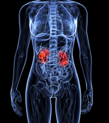 Cáncer Renal