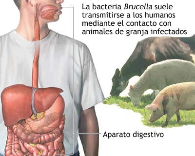 Dos casos de brucelosis en Guasdualito