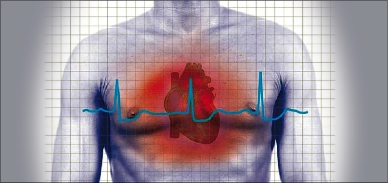 Ahora sí es posible reducir el riesgo de muerte luego de un Infarto