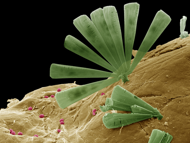 Los microbios que comen plástico en el mar (Foto)