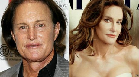 Entérate cuánto gastó Bruce Jenner en su nuevo rostro