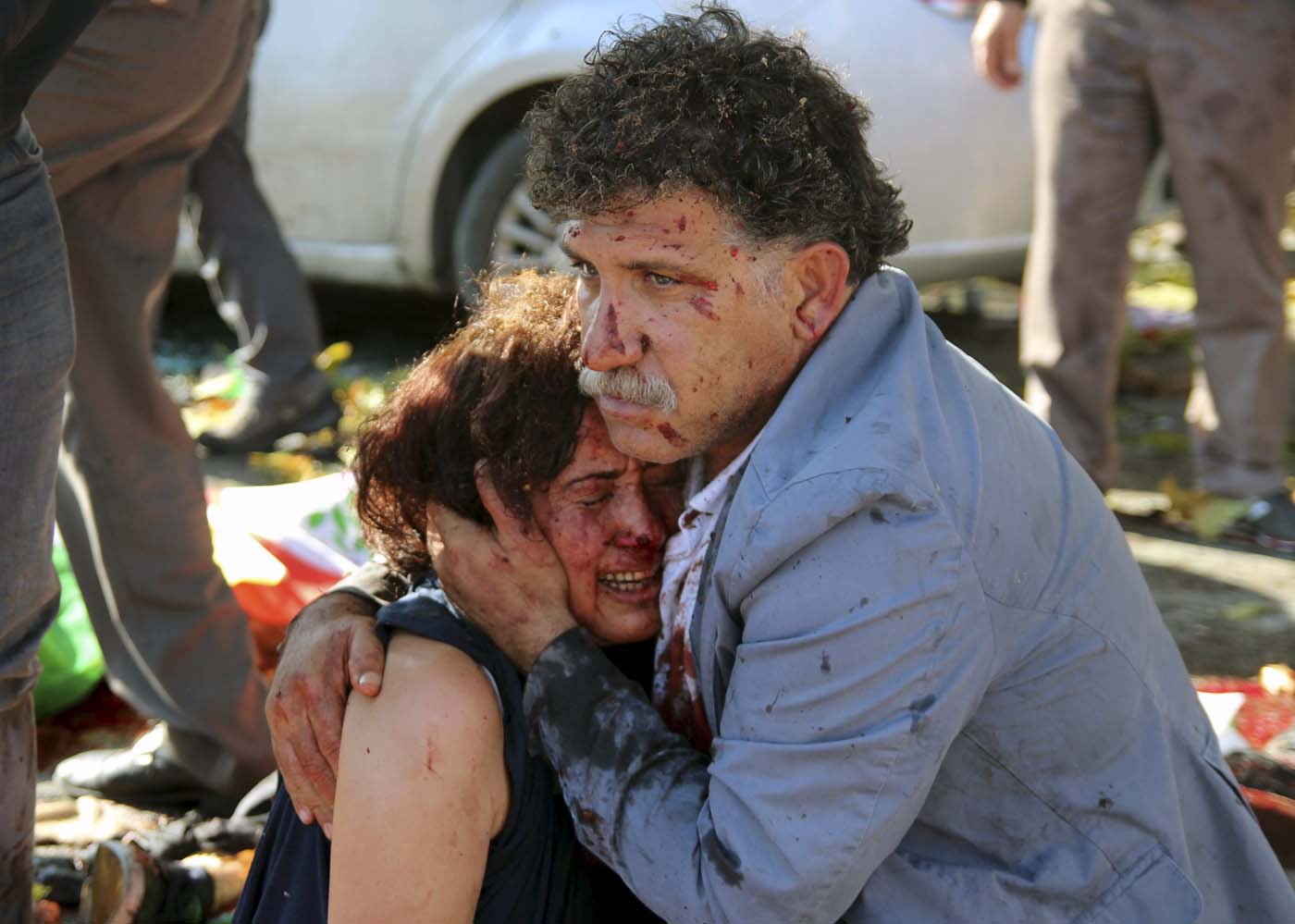 Una marcha por la paz se convierte en escenario de guerra en Ankara (Fotos)