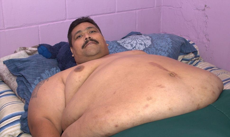 Muere en México el hombre más obeso del mundo