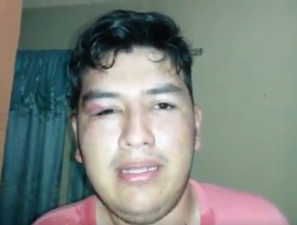 Agredieron a coordinador de Voluntad Popular y le dispararon perdigones a quemarropa (Video)