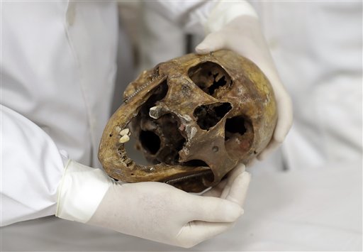 En esta fotografía del 7 de diciembre de 2016, el doctor forense Daniel Muñoz muestra el cráneo del criminal de guerra nazi Josef Mengele, en la escuela de medicina de la Universidad de Sao Paulo, en Sao Paulo, Brasil, En un giro irónico que muchos sobrevivientes del Holocausto podrían ver como una forma de justicia, estudiantes de medicina forense en Brasil aprovechan en su preparación los restos de Mengele, el famoso Angel de la Muerte del campo de concentración de Auschwitz, donde efectuó horribles experimentos con miles de judíos. (AP Foto/Andre Penner)