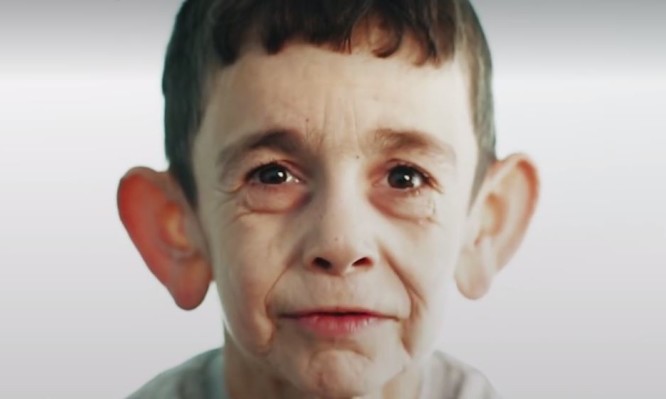 Este niño de 7 años posee el aspecto de un anciano (Fotos + Video)