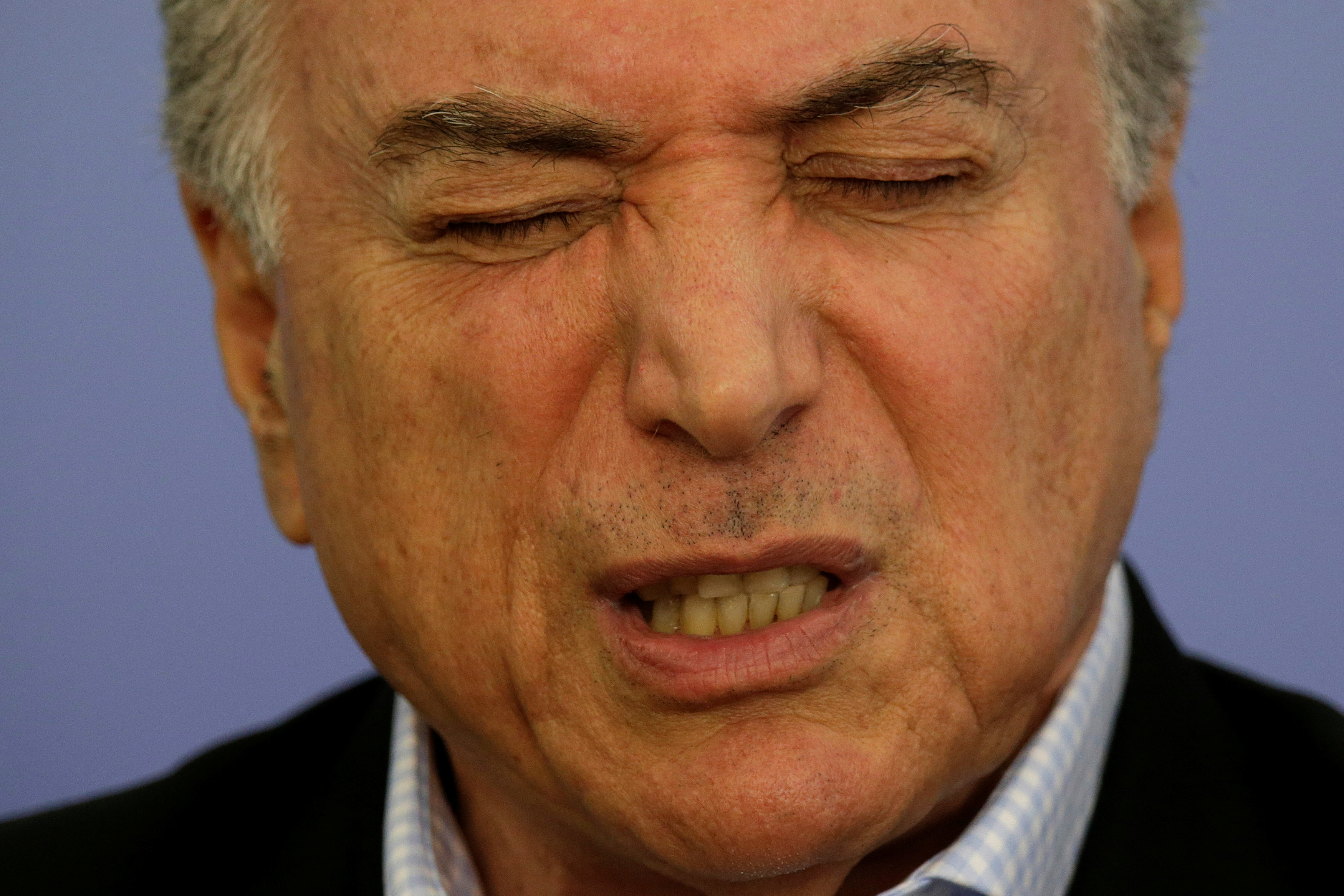 Temer admite que tiene una obstrucción coronaria y debe someterse a una operación