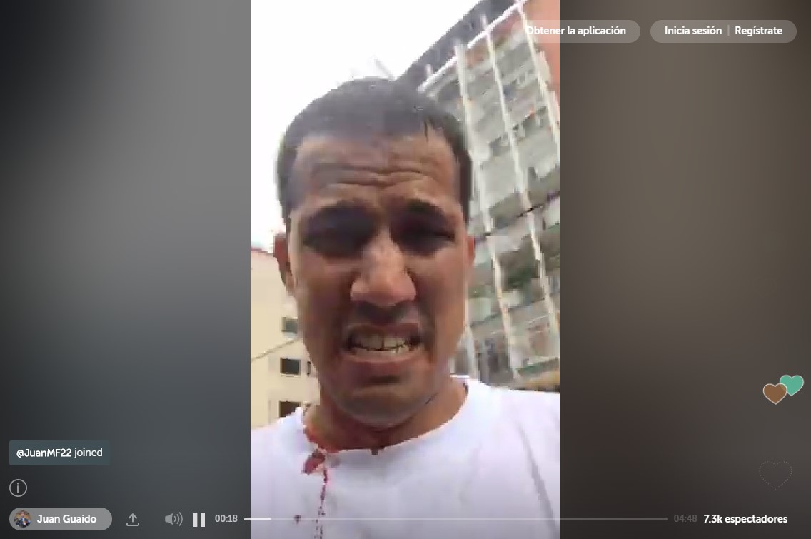 Diputado Juan Guaidó denuncia que recibió un impacto de perdigón en el cuello este #28Jun (+Video)