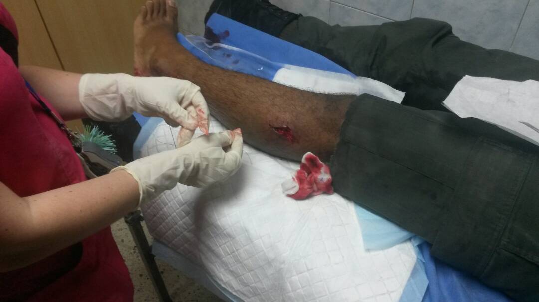 Herido Guardia Nacional en La Yaguara