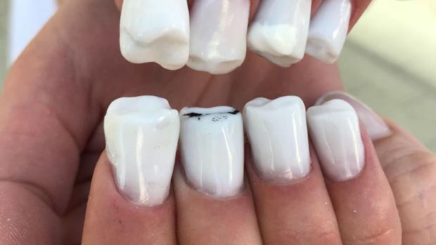 Uñas con forma de dientes se ponen de moda en Rusia