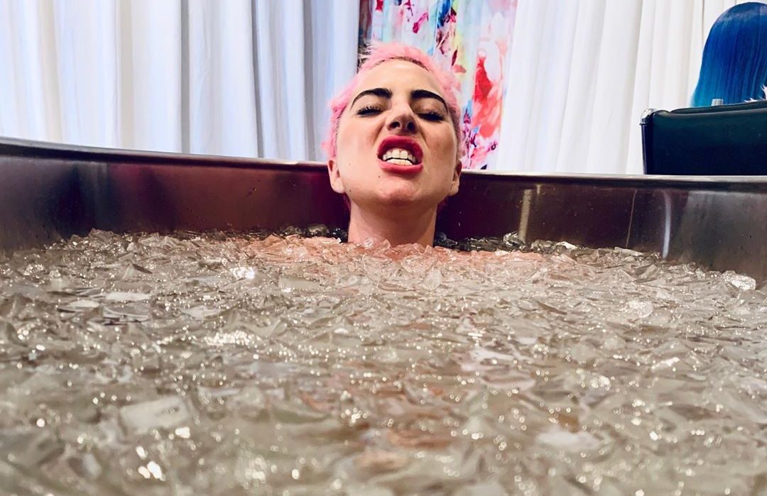 Lady Gaga DESNUDA mientras toma un baño de hielo después de una CAÍDA en el escenario (Fotos)