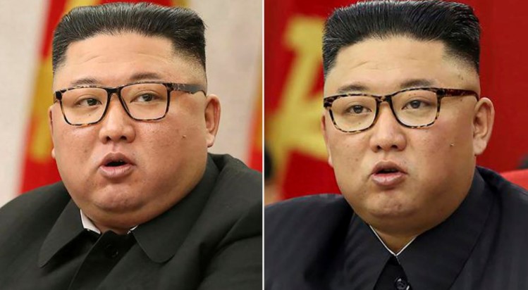 El antes y después de Kim Jong Un y las especulaciones sobre su estado de salud
