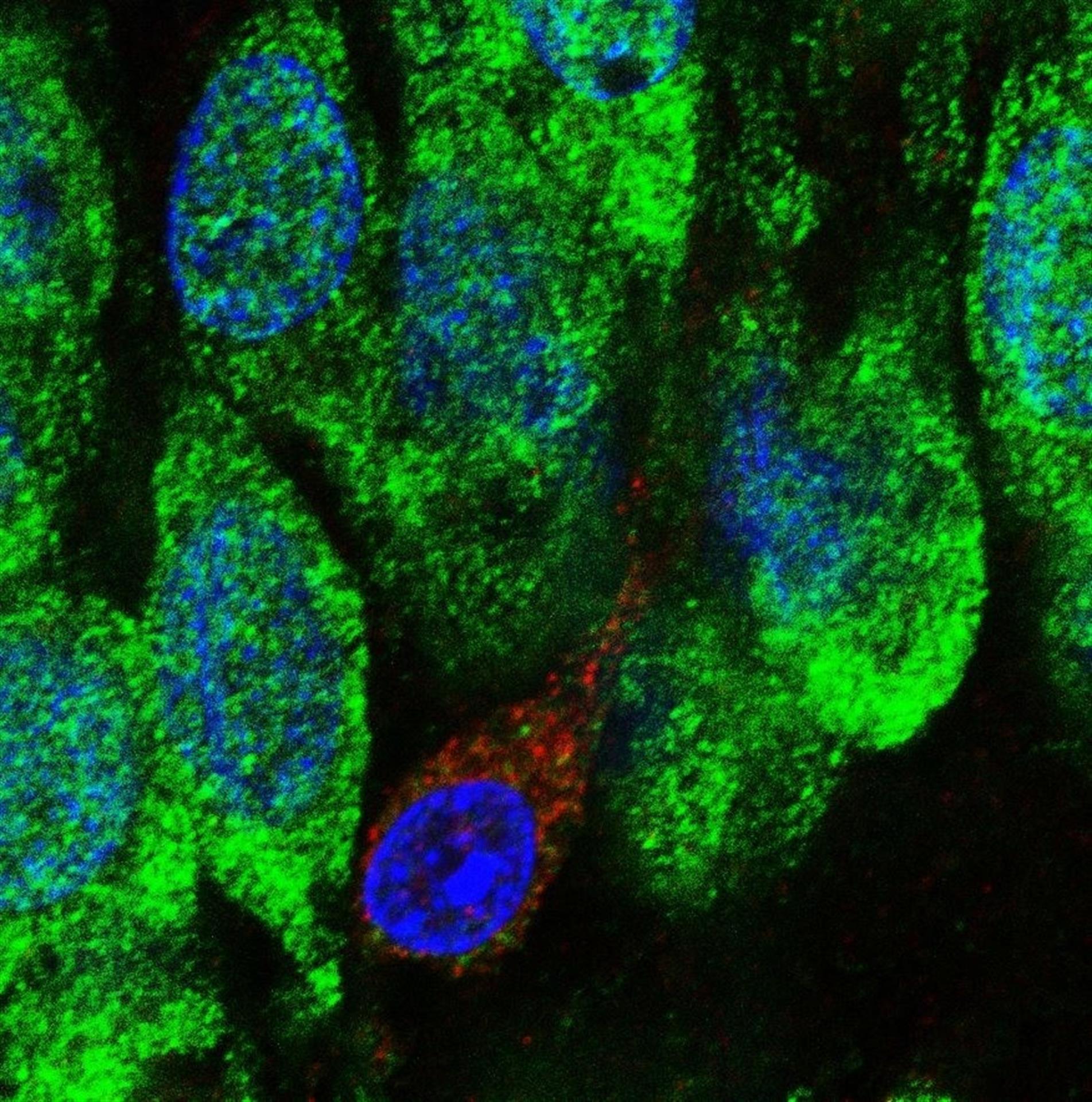 Descubren células madre en el hipocampo del cerebro humano que permiten generar neuronas