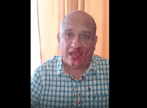En Zulia: Colectivos rojos hieren al diputado legislativo Eduardo Labrador (VIDEO)