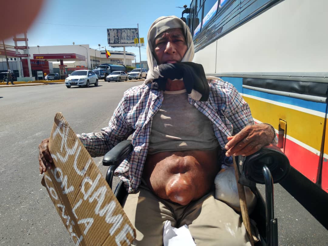 Daniel Áñez, el zuliano que desde la calle pide una oportunidad para seguir viviendo