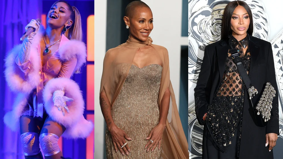 No sólo Jada Pinkett Smith ha sufrido problemas capilares, otras famosas también los han padecido