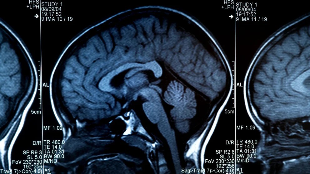 El cerebro humano se expande y se contrae con el paso del tiempo: estos gráficos muestran cómo