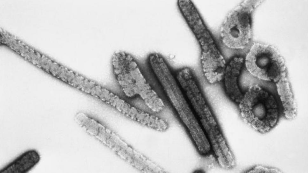 Síntomas, periodo de incubación y forma de contagio del virus de Marburgo, la mortal enfermedad que ha puesto en alerta a la OMS