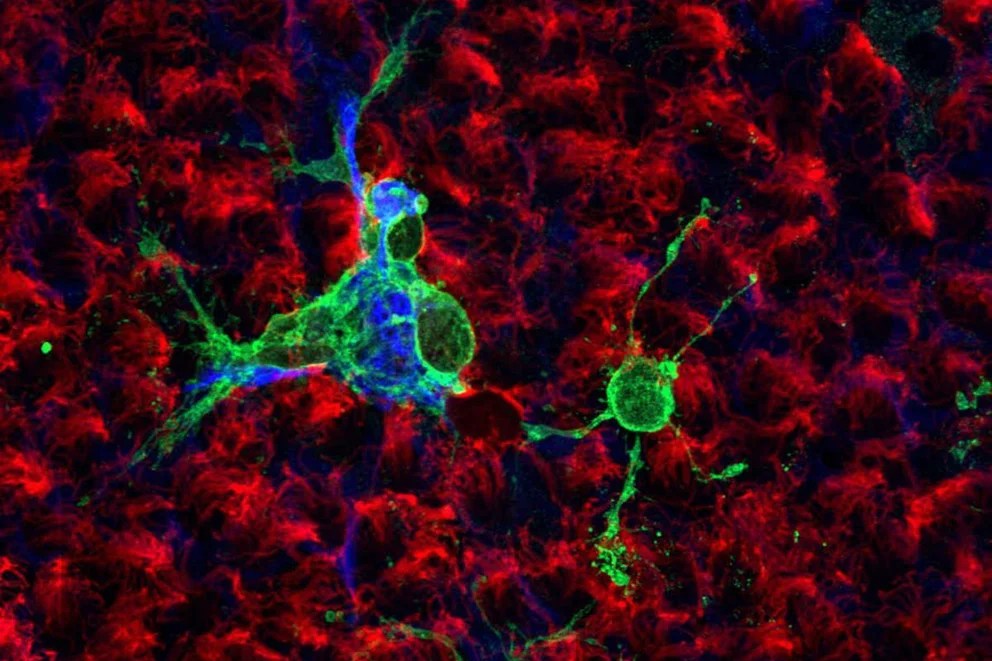 De qué forma el Covid infecta a las células claves del cerebro, según un estudio