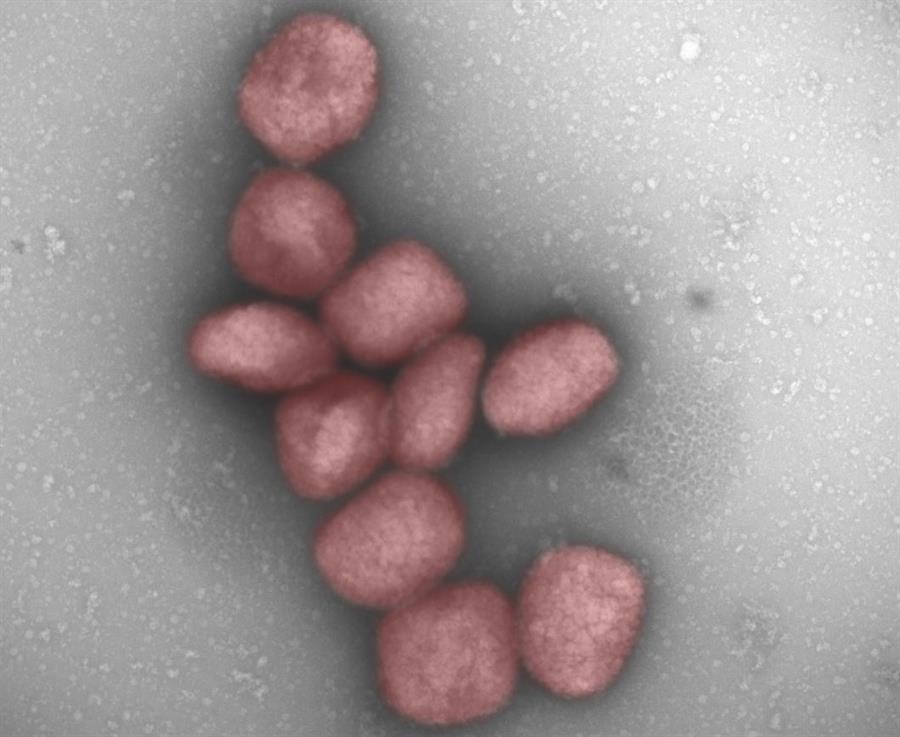 El virus de la viruela del mono podría transmitirse también por vía aérea