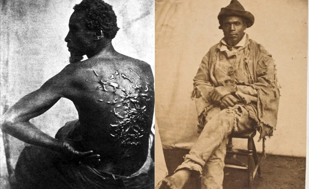 La espalda surcada por enormes cicatrices de “Peter azotado” que reveló el horror de la esclavitud