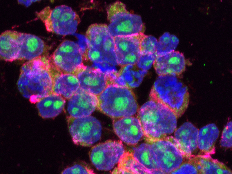 Crean nanocápsulas con control remoto para ampliar efecto de quimioterapias