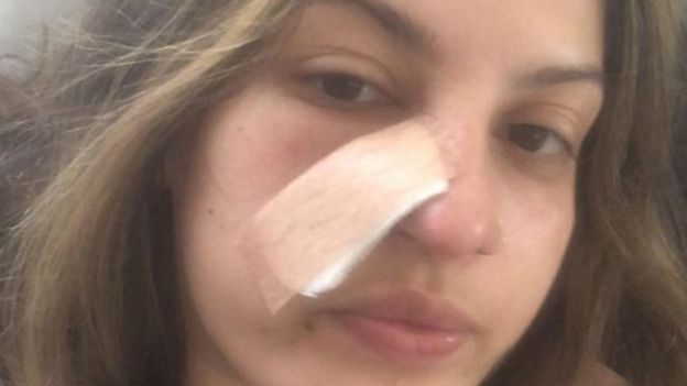 “Una limpieza facial me hizo descubrir que tenía cáncer”: cómo un procedimiento estético le salvó la vida a una mujer