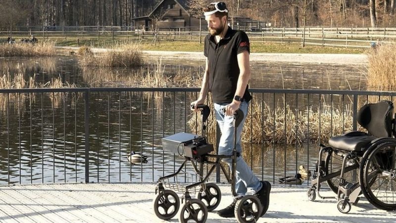 Volvió a caminar después de 12 años gracias a un revolucionario implante cerebral