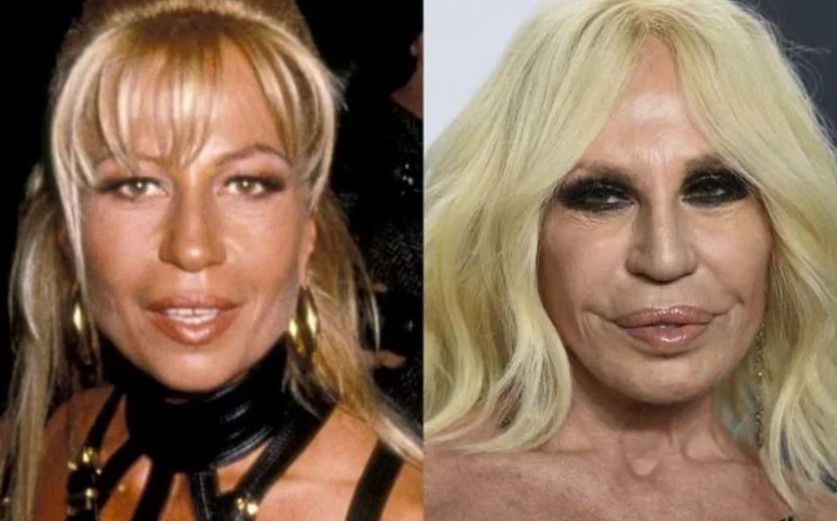 Adicción a la cocaína y a las cirugías y el amor con su hermano: Donatella Versace, la heredera del exceso