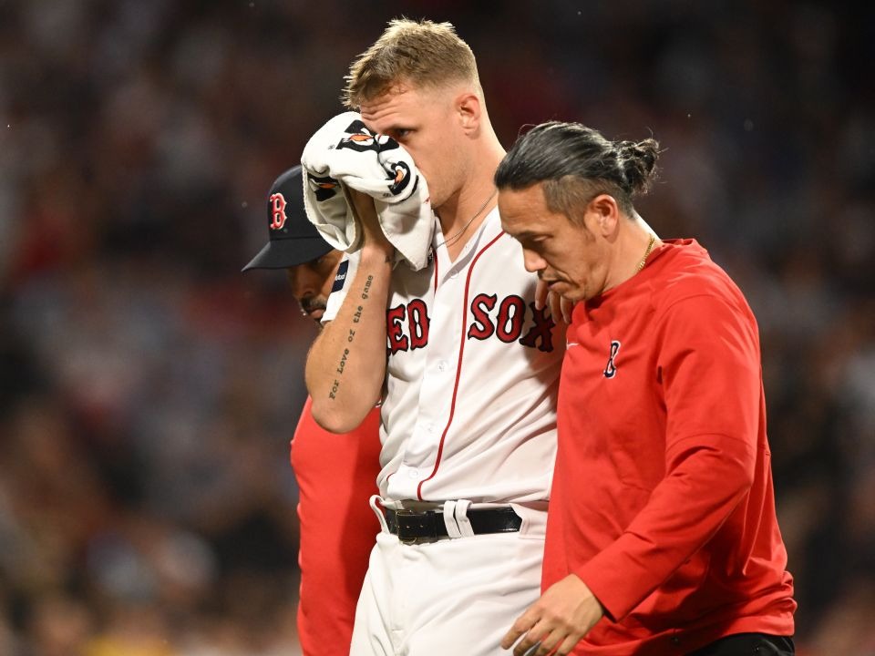 Pitcher de Medias Rojas recibió un duro pelotazo en el rostro que lo dejó con terrible fractura (VIDEO)