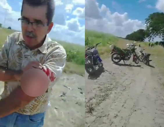 A productor de Portuguesa le quitaron sus tierras… ¡a machetazos! (Video)