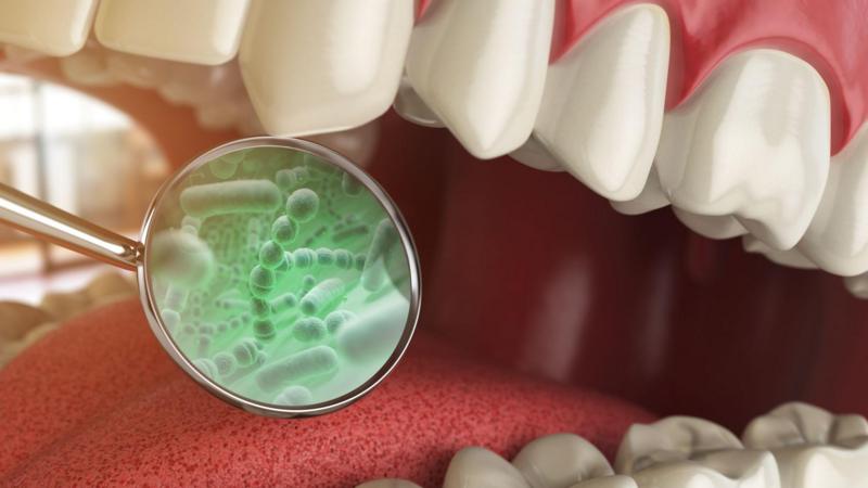 Atención: cáncer de colon y otras tres enfermedades vinculadas con las bacterias que se encuentran en tu boca
