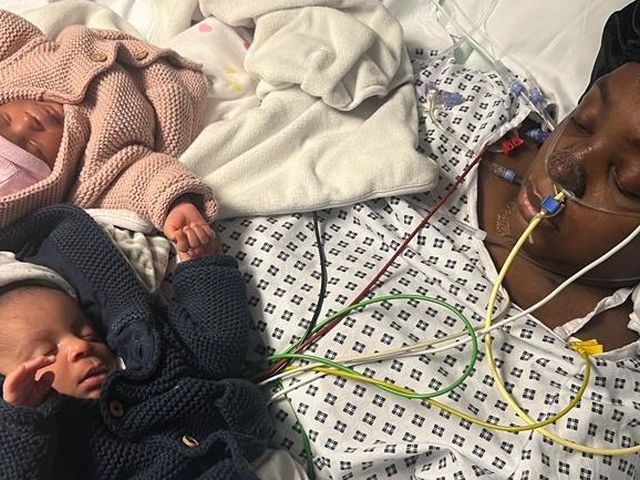 Madre sufrió amputación de manos y piernas tras dar a luz a gemelos