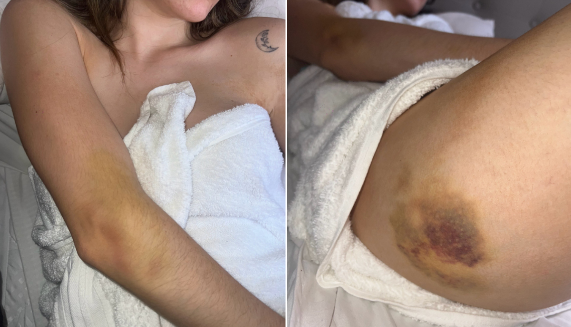 El desgarrador testimonio de una modelo venezolana que denunció ser abusada por un gringo en Medellín