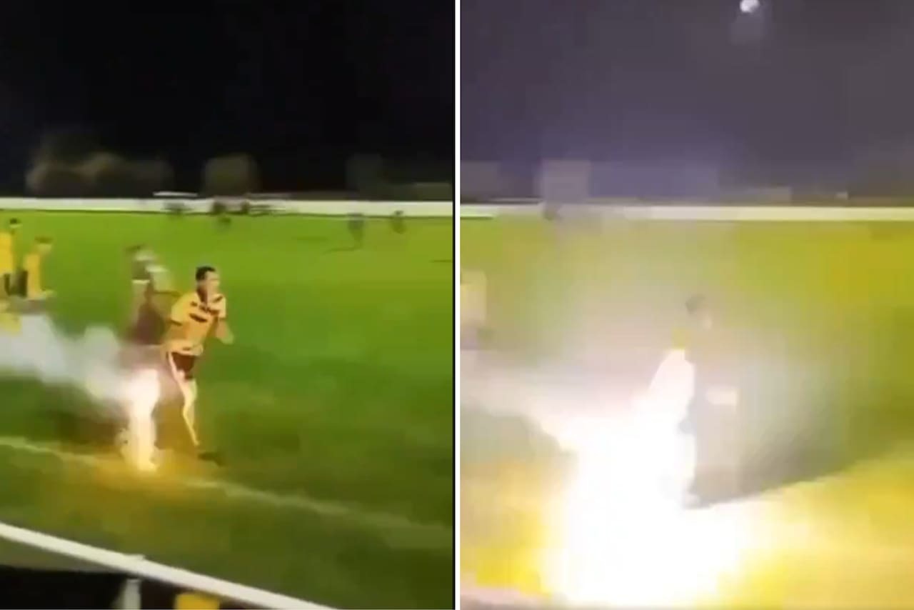 Futbolista perdió varios dedos luego que le explotara un fuego artificial lanzado por sus propios hinchas