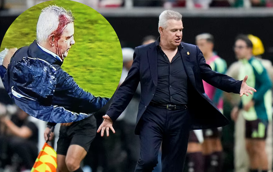 VIDEO: entrenador mexicano Javier Aguirre sufrió corte en la cabeza por una lata arrojada desde la grada